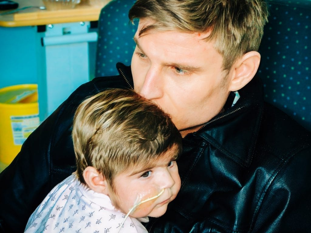 A man with blond hair hugs and kisses the head of a young child who has a medical feeding tube attached to their face. The child looks off to the side while resting in the mans arms.