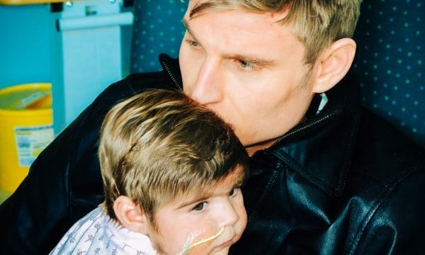 A man with blond hair hugs and kisses the head of a young child who has a medical feeding tube attached to their face. The child looks off to the side while resting in the mans arms.